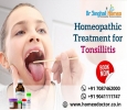 Get an Effective Homeopathic Treatment for Tonsillitis